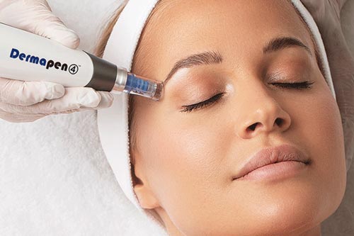 TRATAMIENTO DERMAPEN 4 SESIONES